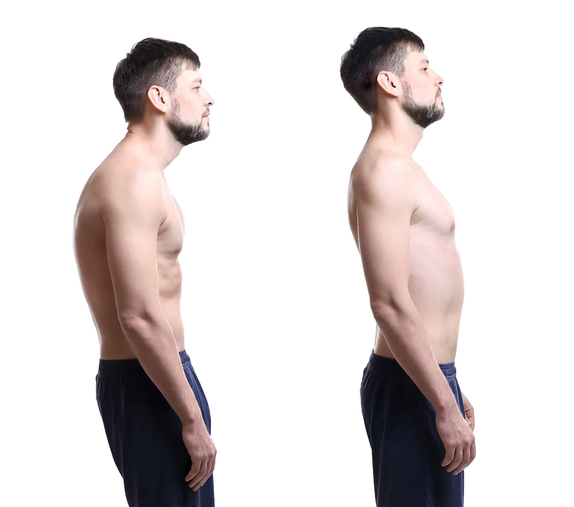 5 Surprising Benefits of Good Posture - Preferred Injury Physicians
