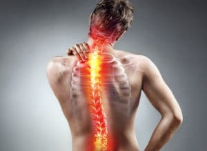 Scoliosis facts and treatment